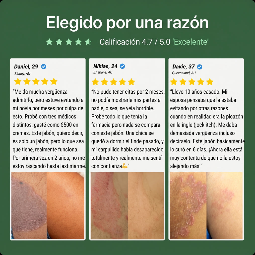 Jabón Veloma™ | Formula natural Antimicótica  - Anti Hongos - Antifúngica