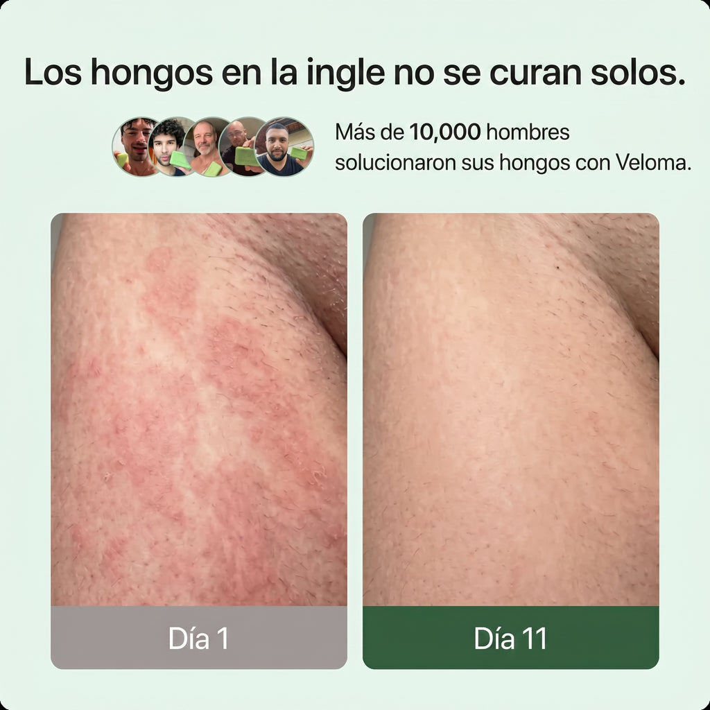 Jabón Veloma™ | Formula natural Antimicótica  - Anti Hongos - Antifúngica